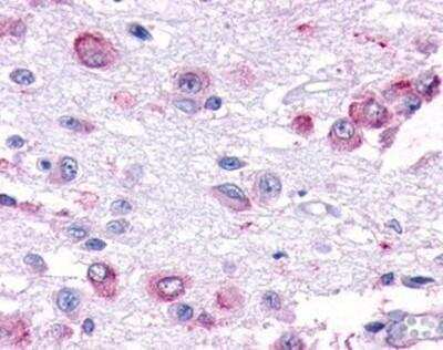 Immunohistochemistry-Paraffin: GPR101 Antibody [NBP1-02676] - Staining of human brain, hypothalamus. Immunohistochemistry of formalin-fixed, paraffin-embedded tissue after heat-induced antigen retrieval. Antibody concentration 3 ug/ml.