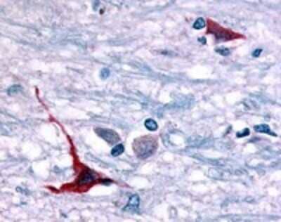 Immunohistochemistry-Paraffin: GPR101 Antibody [NLS8066] - Analysis of anti-GPCR6 / GPR101 antibody with brain, hypothalamus at 3 ug/ml.