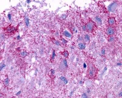 Immunohistochemistry-Paraffin: GPR101 Antibody [NLS8066] - Analysis of anti-GPCR6 / GPR101 antibody with human brain, glioblastoma.