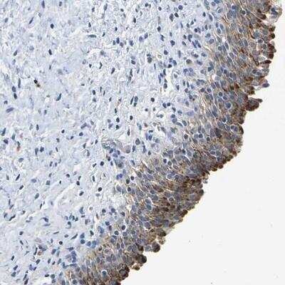 Immunohistochemistry GPR103 Antibody - BSA Free