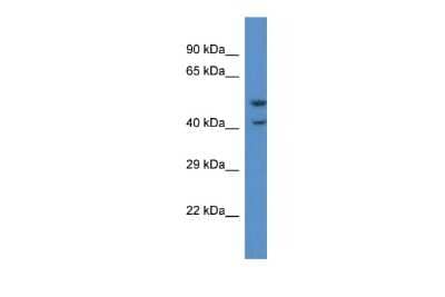 Western Blot: GPR103 Antibody [NBP2-85002] - WB Suggested Anti-QRFPR Antibody. Titration: 1.0 ug/ml. Positive Control: Jurkat Whole Cell