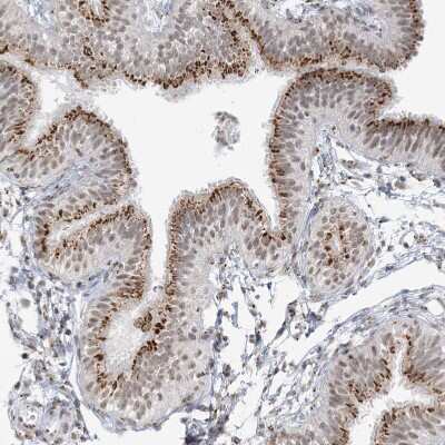Immunohistochemistry-Paraffin: GPR107 Antibody [NBP1-83629] - Staining of human Fallopian tube shows strong positivity in Golgi apparatus in glandular cells.