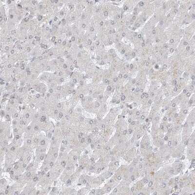 Immunohistochemistry-Paraffin: GPR107 Antibody [NBP1-83629] - Staining of human liver shows no positivity in hepatocytes as expected.