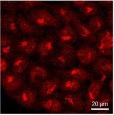 Immunocytochemistry/Immunofluorescence: GPR108 Antibody [NBP2-56970] - HeLa cells fixed in 4% PFA, permeablised with TRITON X-100 and stained with anti-GPR108 and an AlexaFluor 546 conjugated secondary antibody. Image from verified customer review.