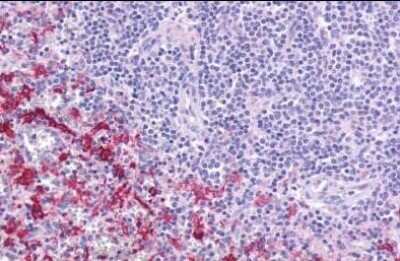 Immunohistochemistry-Paraffin: GPR109B/HM74 Antibody [NLS179] - Analysis of anti-GPR109B / HM74 antibody with human spleen.