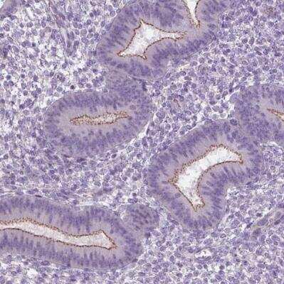 Immunohistochemistry-Paraffin: GPR110 Antibody [NBP1-89700] -  Staining of human endometrium shows membranous positivity in glandular cells.