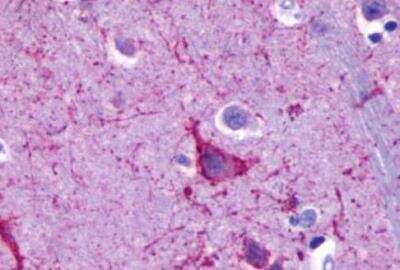 Immunohistochemistry-Paraffin: GPR110 Antibody [NLS2019] - Brain, Caudate, Neurons and glia