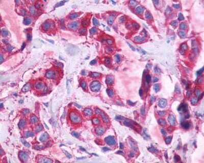 Immunohistochemistry-Paraffin GPR110 Antibody - BSA Free