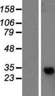 Western Blot: GPR110 Overexpression Lysate (Adult Normal) [NBP2-06246] Left-Empty vector transfected control cell lysate (HEK293 cell lysate); Right -Over-expression Lysate for GPR110.