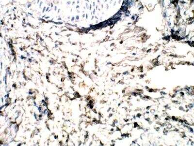 Immunohistochemistry-Paraffin GPR113 Antibody