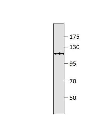 Western Blot GPR113 Antibody