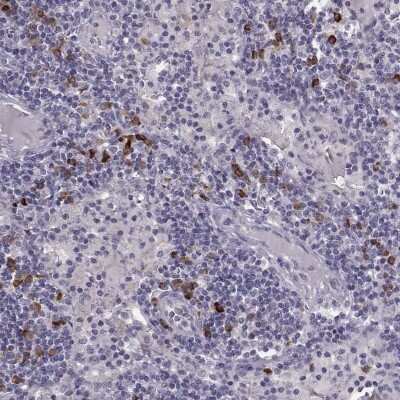 Immunohistochemistry-Paraffin GPR114 Antibody