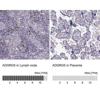 Immunohistochemistry-Paraffin GPR114 Antibody