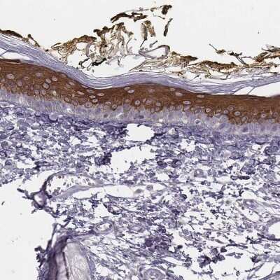 <b>Orthogonal Strategies Validation. </b>Immunohistochemistry-Paraffin: GPR115 Antibody [NBP2-58896] - Staining of human skin shows strong cytoplasmic positivity in keratinocytes.