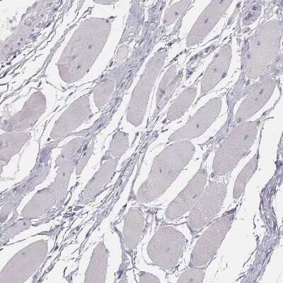 Immunohistochemistry-Paraffin: GPR115 Antibody [NBP2-58896] - Staining of human skeletal muscle shows no positivity in myocytes as expected.