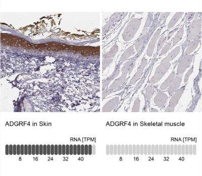 Immunohistochemistry-Paraffin: GPR115 Antibody [NBP2-58896] - Analysis in human skin and skeletal muscle tissues. Corresponding ADGRF4 RNA-seq data are presented for the same tissues.