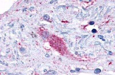 Immunohistochemistry-Paraffin: GPR116 Antibody [NLS1513] - Brain, substantia nigra