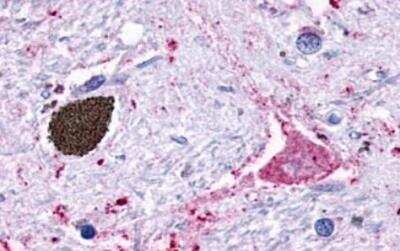 Immunohistochemistry-Paraffin GPR116 Antibody - BSA Free