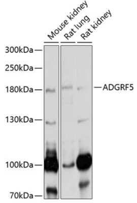 Western Blot: GPR116 Antibody [NBP3-03588] - Analysis of extracts of various cell lines, using GPR116 antibody at 1:1000 dilution. Secondary antibody: HRP Goat Anti-Rabbit IgG (H+L) at 1:10000 dilution. Lysates/proteins: 25ug per lane. Blocking buffer: 3% nonfat dry milk in TBST. Detection: ECL Basic Kit.