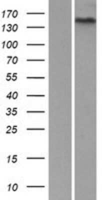 Western Blot: GPR116 Overexpression Lysate (Adult Normal) [NBP2-10293] Left-Empty vector transfected control cell lysate (HEK293 cell lysate); Right -Over-expression Lysate for GPR116.