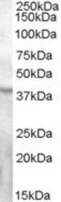 Western Blot: GPR119 Antibody [NB100-94884] - (0.3ug/ml) staining of Human Ovary lysate (35ug protein in RIPA buffer). Primary incubation was 1 hour. Detected by chemiluminescence.