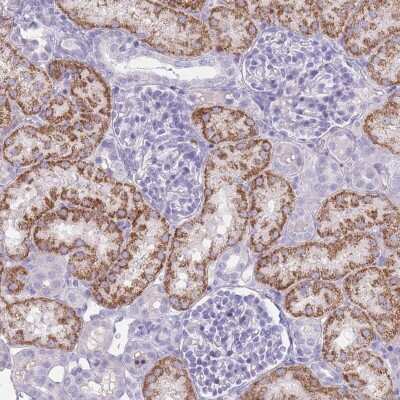 Immunohistochemistry: GPR12 Antibody [NBP2-48989] - Staining of human kidney shows strong cytoplasmic positivity in cells in tubules.