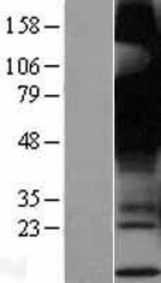 Western Blot: GPR12 Overexpression Lysate (Adult Normal) [NBP2-04285] Left-Empty vector transfected control cell lysate (HEK293 cell lysate); Right -Over-expression Lysate for GPR12.
