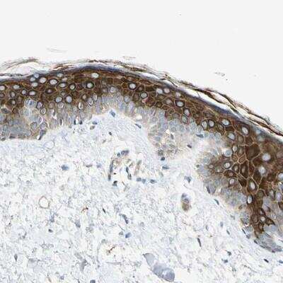 Immunohistochemistry-Paraffin GPR125 Antibody