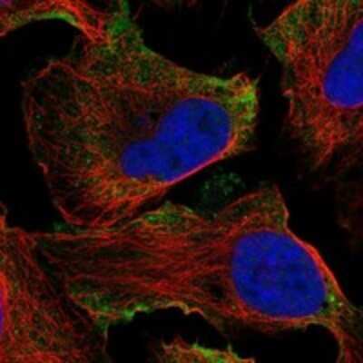 Immunocytochemistry/Immunofluorescence: GPR133 Antibody [NBP3-17256] - Staining of human cell line U-2 OS shows localization to plasma membrane.