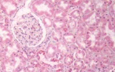 Immunohistochemistry-Paraffin GPR133 Antibody - BSA Free