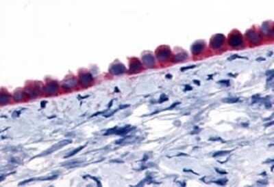 Immunohistochemistry-Paraffin: GPR133 Antibody [NLS2034] - Analysis of anti-GPR133 antibody with human ovary, epithelium.
