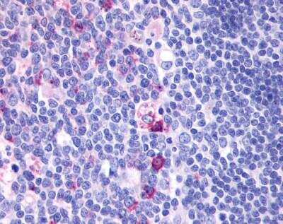 Immunohistochemistry-Paraffin: GPR137 Antibody [NLS2059] - Analysis of anti-GPR137 antibody with human tonsil.