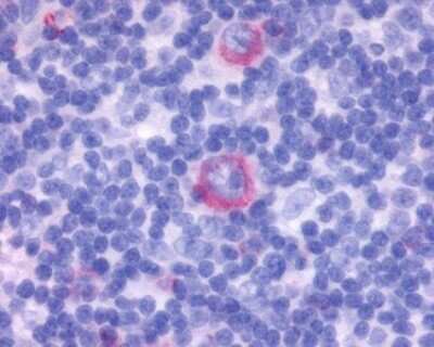 Immunohistochemistry-Paraffin: GPR137 Antibody [NLS2059] - Analysis of anti-GPR137 antibody with human lymph node, Hodgkins lymphoma.