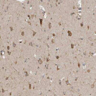 Immunohistochemistry-Paraffin: GPR137B Antibody [NBP1-86934] - Staining of human cerebral cortex shows strong nucleolar and cytoplasmic positivity in neuronal cells.