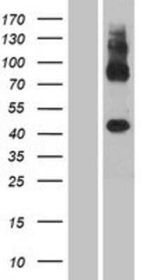 Western Blot: GPR137C Overexpression Lysate (Adult Normal) [NBP2-08286] Left-Empty vector transfected control cell lysate (HEK293 cell lysate); Right -Over-expression Lysate for GPR137C.