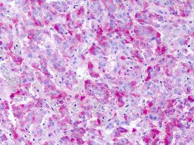 Immunohistochemistry-Paraffin: GPR139 Antibody [NLS2716] - Analysis of human adrenal, medulla.