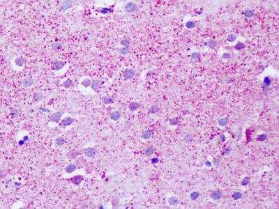 Immunohistochemistry-Paraffin: GPR139 Antibody [NLS2716] - Analysis of human brain, cortex.
