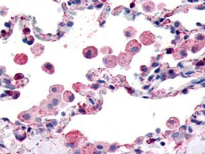 Immunohistochemistry-Paraffin: GPR139 Antibody [NLS2719] - Lung, alveoli, and alveolar macrophages