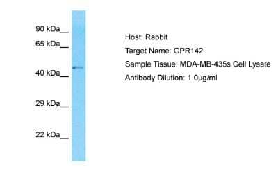 Western Blot GPR142 Antibody - BSA Free