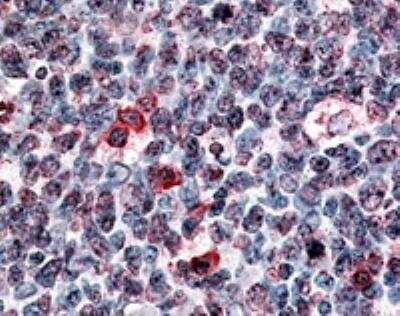 Immunohistochemistry-Paraffin: GPR146 Antibody [NLS1986] - IHC analysis of Tonsil Germinal Center using NLS1986 at 25 ug/ ml.
