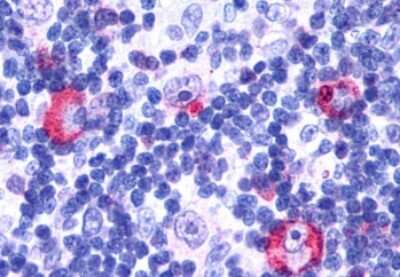 Immunohistochemistry-Paraffin: GPR146 Antibody [NLS1988] - Anti-GPR146 antibody IHC of human Lymph Node, Hodgkins Lymphoma. Immunohistochemistry of formalin-fixed, paraffin-embedded tissue after heat-induced antigen retrieval.