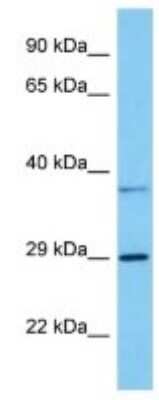 Western Blot GPR146 Antibody - BSA Free
