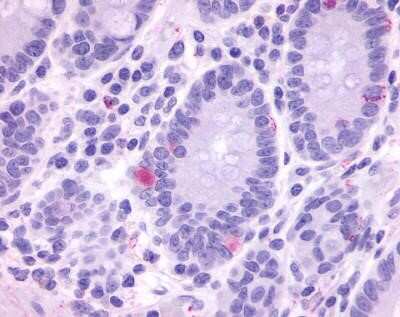 Immunohistochemistry-Paraffin: GPR148 Antibody [NLS3184] - Analysis of anti-GPR148 antibody with small intestine, crypts