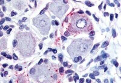 Immunohistochemistry-Paraffin: GPR149 Antibody [NB100-59002] - Staining of human spinal cord, dorsal root ganglion. Immunohistochemistry of formalin-fixed, paraffin-embedded tissue after heat-induced antigen retrieval. Antibody concentration 20 ug/ml.