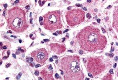 Immunohistochemistry-Paraffin: GPR149 Antibody [NB100-59003] - Staining of human spinal cord, dorsal root ganglion. Immunohistochemistry of formalin-fixed, paraffin-embedded tissue after heat-induced antigen retrieval. Antibody concentration 5 ug/ml.