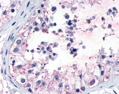 Immunohistochemistry-Paraffin: GPR149 Antibody [NLS5107] - Analysis of anti-GPR149 antibody with human testis, seminiferous epithelium.