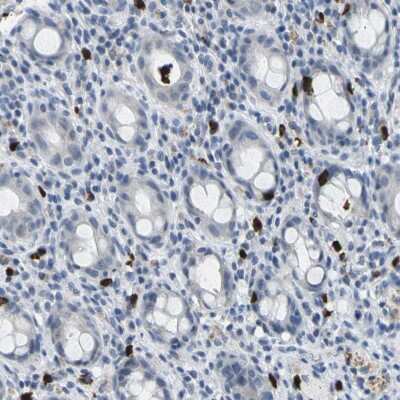 Immunohistochemistry-Paraffin: GPR15 Antibody [NBP1-87574] - Staining of human rectum shows positivity in immune cells.