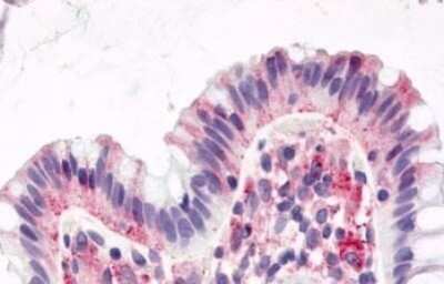 Immunohistochemistry-Paraffin: GPR15 Antibody [NLS1613] - Anti-GPR15 antibody IHC of human colon, surface epithelium. Immunohistochemistry of formalin-fixed, paraffin-embedded tissue after heat-induced antigen retrieval.
