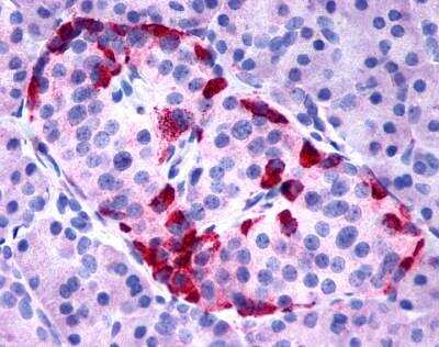 Immunohistochemistry-Paraffin: GPR15 Antibody [NLS6285] - Analysis of anti-GPR15 antibody with pancreas, islet of langerhans