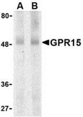 Western Blot: GPR15 Antibody [NBP1-76466] - Human spleen lysate with GPR15 antibody at (A) 0.5 and (B) 1 u/mL.